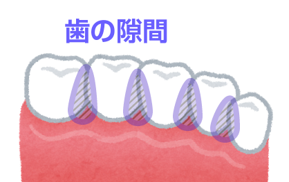 歯間